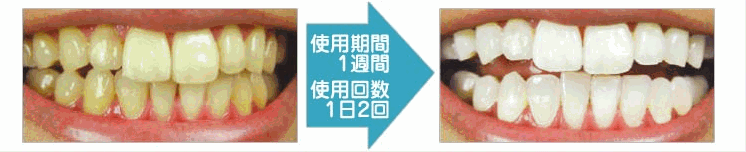 �p�[���z���C�g�v��EX,����,���R�~,�u���O,�y�V,���t�[